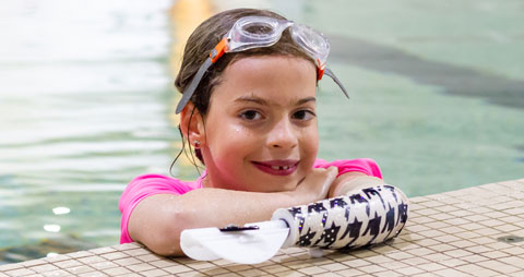 A child amputee wearing her water arm in a swimming pool.
