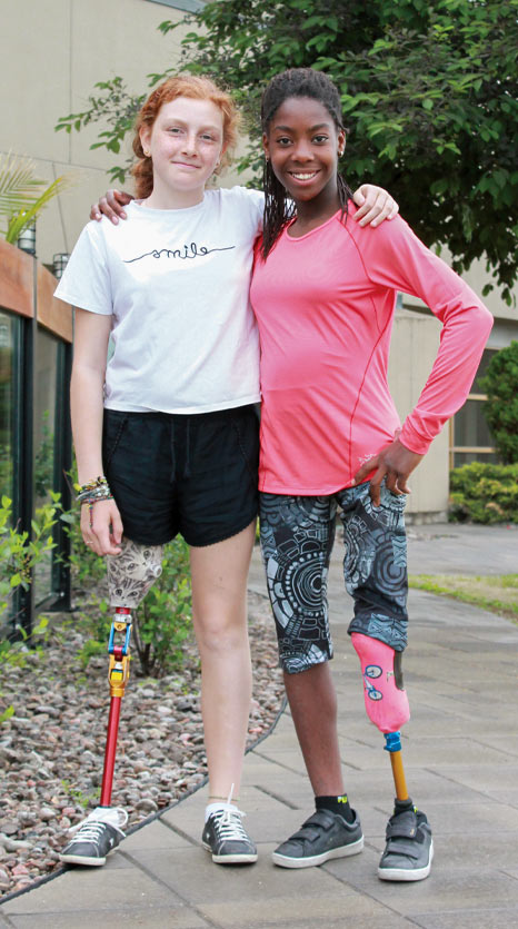 Two young female leg amputees standing on a path with their arms around each other’s shoulders.