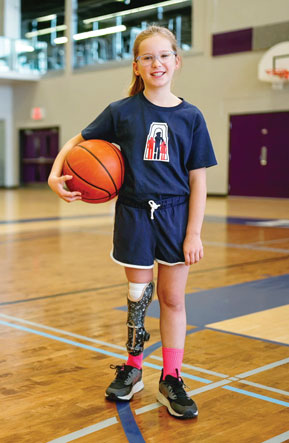 A young female leg amputee holds a basketball while standing on an empty basketball court.