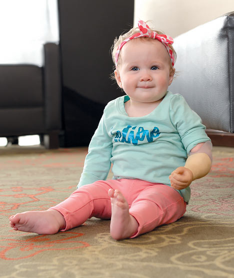 Une petite fille portant un bras artificiel est assise sur le plancher.