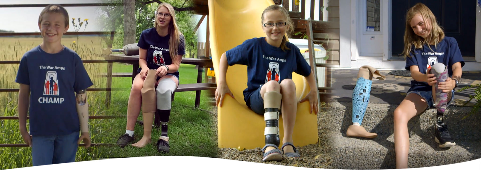 A collage of four child amputees wearing their artificial limbs.