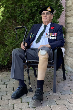 Second World War amputee veteran Charlie Jefferson was injured by an anti-personnel mine explosion, resulting in the loss of his left leg.