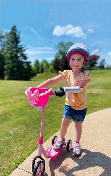 A young female arm amputee riding her scooter using an artificial arm attached to the handlebar.