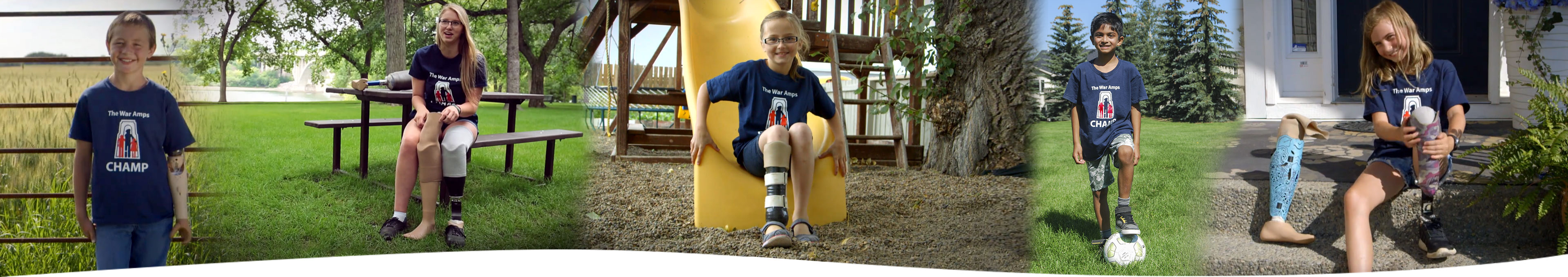 A collage of five child amputees wearing their artificial limbs.