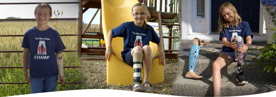 A collage of three child amputees wearing their artificial limbs.