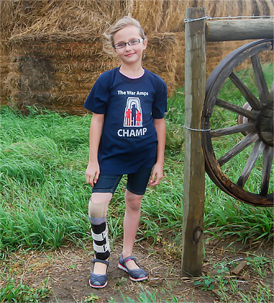 Champ Neveah wearing her artificial leg standing in front of bales of hay on a farm.