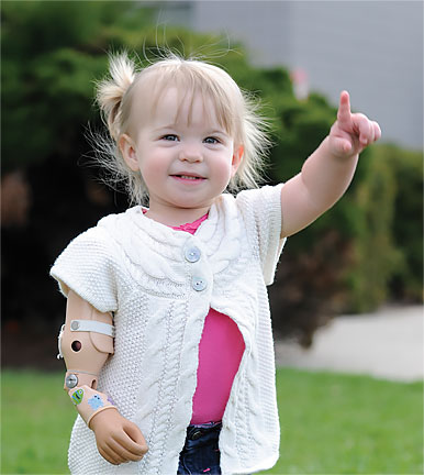 A baby girl wearing her prosthetic arm pointing to the sky.