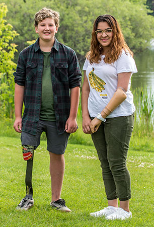 A teenage male leg amputee stands next to a teenage female arm amputee on a field. 