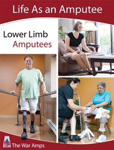 WCA Introduces LUVO as a Solution for Eliminating Amputations and