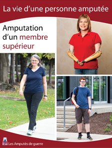 La vie d’une personne amputée – Amputation d’un membre supérieur