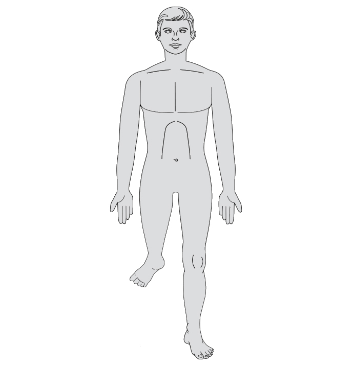 An anatomy-style illustration of a man's body showing a Rotationplasty (Van Nes Rotation).